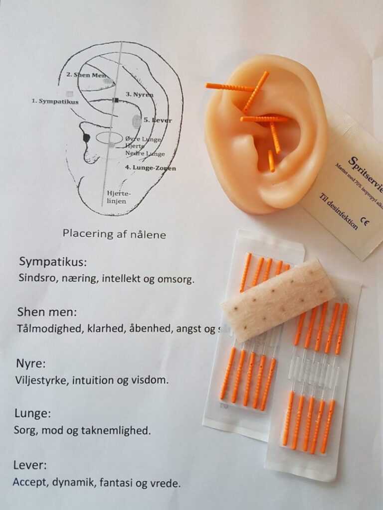NADA Akupunktur Klinik Susse L s Mere Her